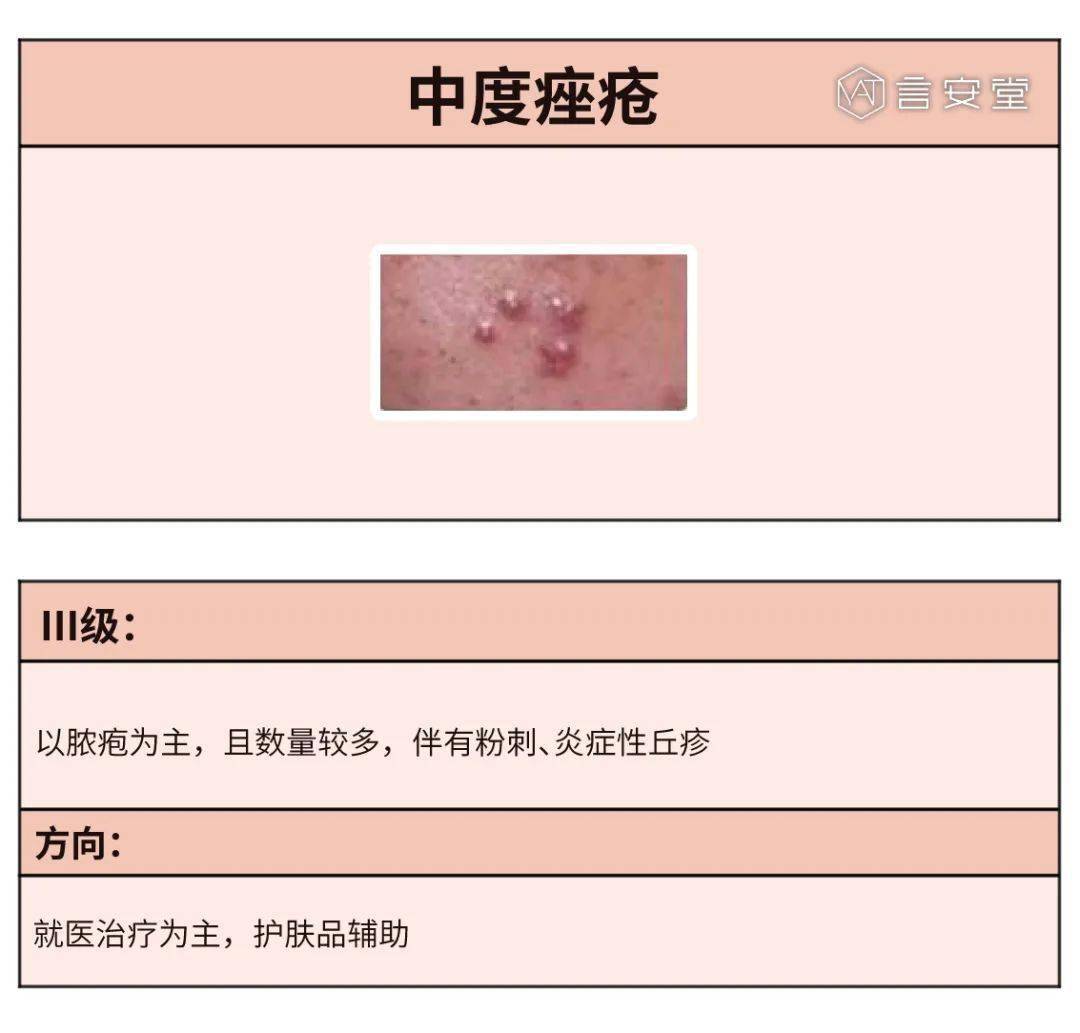 北京医院治疗痤疮青春痘,北京医院治疗痤疮青春痘的实时解答解析说明,实地分析数据设计_望版32.39.26