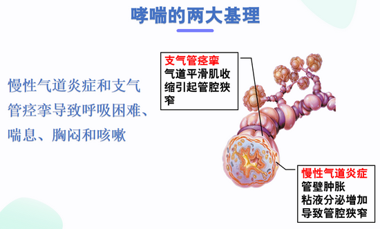 哮喘的主要症状是能治好么?