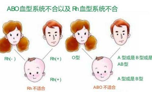 o血型跟o血型会溶血吗,O血型与O血型之间的相容性探讨，深入数据执行策略解析,权威数据解释定义_Harmony32.32.23