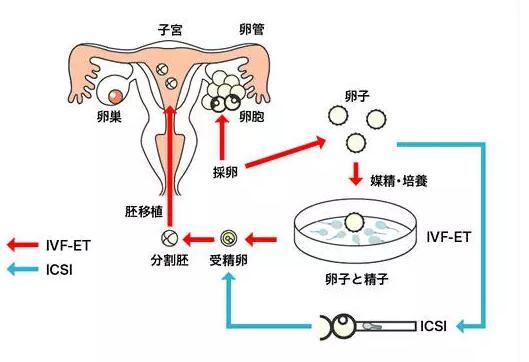 三代试管婴儿的费用大约是