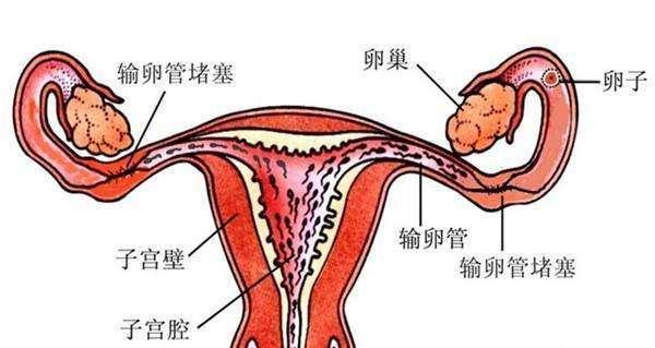 输卵管性不孕检查排卵