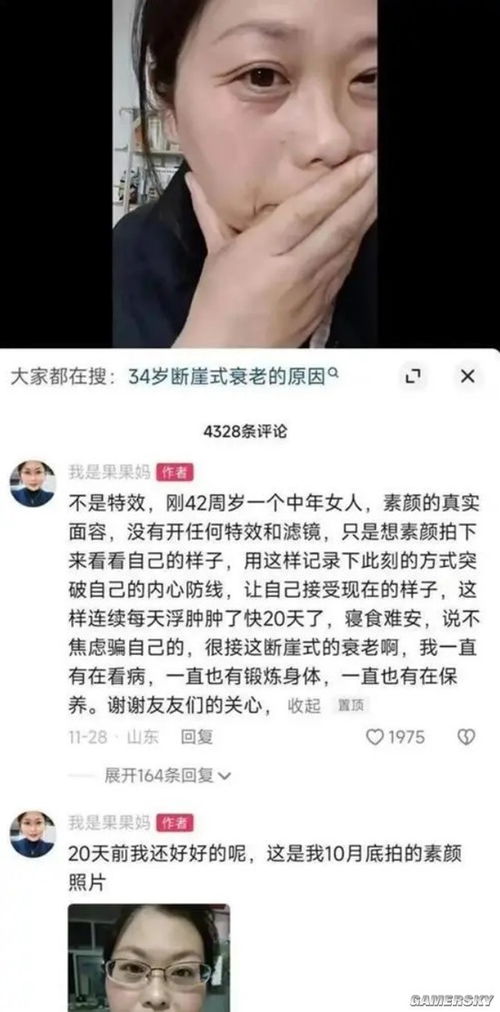 女生确诊渐冻症容貌巨变 母亲回应